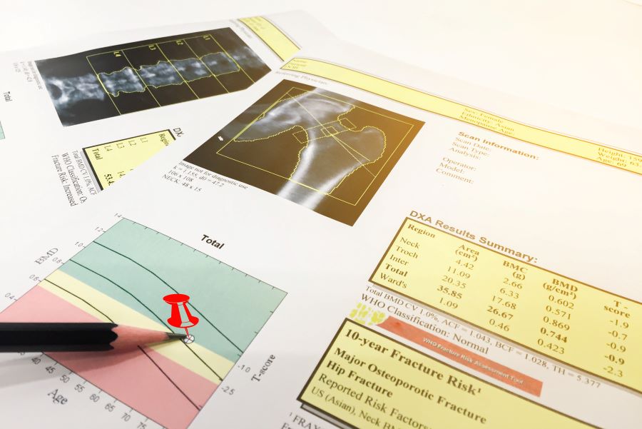 Ernaehrungszentrum Zug | Osteoporose DEXA Scan